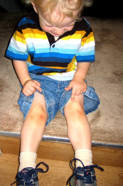 knees.jpg