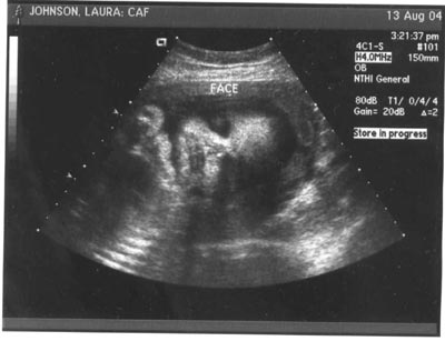 TheBean_7-months_face.jpg